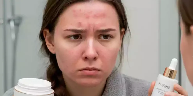 Waspada! 5 Tanda Kulit Tidak Sesuai dengan Skincare yang Digunakan